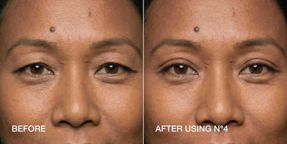 Invisible Eyelid Lift Strips for Hooded Eyes - Instant Eye-Opening Effect - 240 Strips + Tweezers