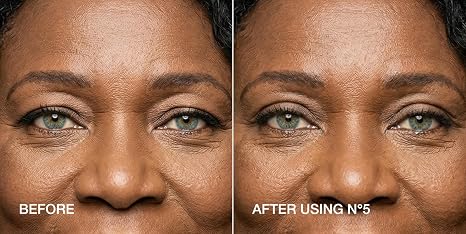 Invisible Eyelid Lift Strips for Hooded Eyes - Instant Eye-Opening Effect - 240 Strips + Tweezers