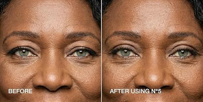 Invisible Eyelid Lift Strips for Hooded Eyes - Instant Eye-Opening Effect - 240 Strips + Tweezers