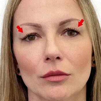 Invisible Eyelid Lift Strips for Hooded Eyes - Instant Eye-Opening Effect - 240 Strips + Tweezers